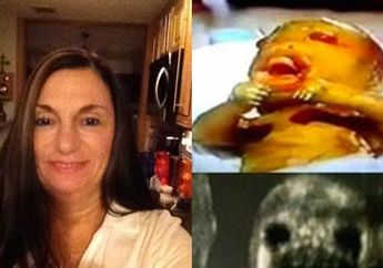 Kisah Kelahiran 'Bayi Setan' Bertahan Hidup Tanpa Air Ketuban di Dalam Rahim