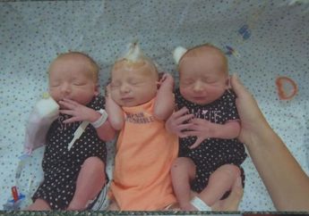 Dikira Idap Batu Ginjal, Ibu ini Justru Lahirkan 3 Orang Bayi