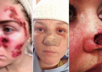 Berniat Untuk Terlihat Eksotis dengan Kulit Gelap, Nasib Para Wanita ini Justru Berakhir Tragis