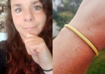 Tak Pernah Lepaskan Karet Gelang di Tangannya Selama 30 Tahun, Wanita ini Alami Kerusakan Saraf Permanen