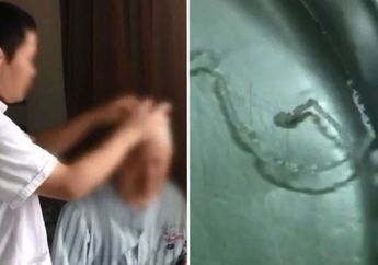 Ngeri! Awalnya Dikira Epilepsi, Saat Benda ini Dikeluarkan dari Tengkorak Kepalanya Pria ini Langsung Sembuh