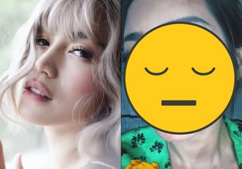 Diduga Alergi Obat Bius, Wajah Mulus Jessica Iskandar Dipenuhi dengan Bercak Merah