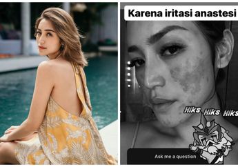 Wajah sang Kekasih Disebut Mengerikan, Richard Kyle Tak Ambil Pusing dan Tetap Semangati Jessica Iskandar : Jangan Khawatir...