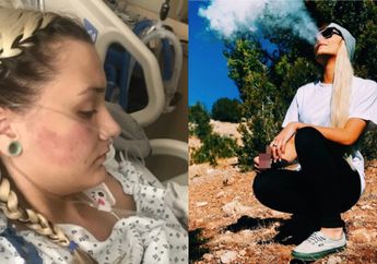 3 Tahun Isap Vape, Remaja 18 Tahun Ini Terbaring Koma dan Derita Sakit Paru-paru Akut