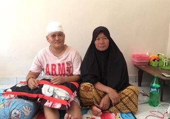 Kepalanya Berlubang Akibat Kesetrum di Tempat Kerja, Desi Butuh Dana hingga Rp 50 Juta untuk Operasi Cangkok
