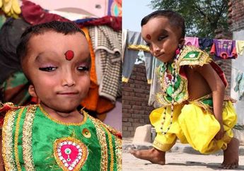 Kisah Bocah India yang Disembah karena Dipercaya sebagai Titisan Dewa Ganesha akibat Punya Kelainan Fisik
