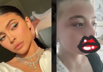 Ingin Miliki Bibir Seksi Layaknya Kylie Jenner, Seorang Gadis 12 Tahun Ikuti Tutorial di Internet, Hasilnya Malah Seperti Disengat Lebah!