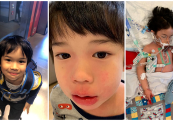 Berawal dari Demam, Bocah 4 Tahun Ini Alami Infeksi Kulit hingga Koma