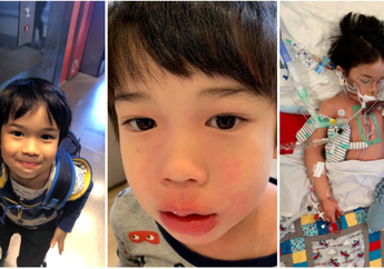 Awalnya Cuma Demam, Bocah 4 Tahun Ini Ternyata Idap Sepsis dan Hampir Tewas Gara-Gara Terinfeksi Bakteri Pemakan Daging Manusia!