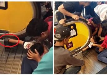 Nahas, Tangan Bocah 3 Tahun Terjepit Eskalator Hingga Sobek, Sang Ibu Diduga Lalai Awasi Anaknya