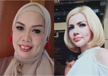 Sama-sama Sulam Lesung Pipi, Elly Sugigi Klaim Pipinya Lebih Cantik Ketimbang Barbie Kumalasari: Mukanya Barbie Kan Udah Peyot!