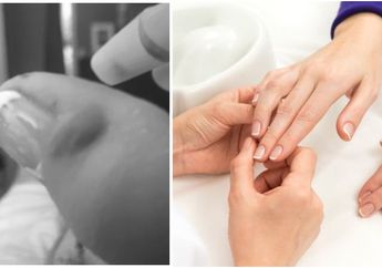 Usai Lakukan Manicure, Tangan Seorang Nenek Nyaris Diamputasi Karena Terinfeksi Bakteri Pemakan Daging