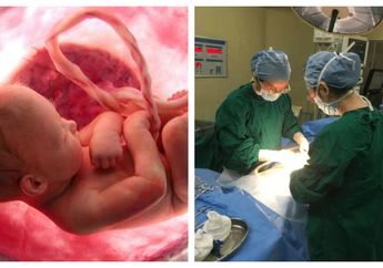 Demi Tanggal Keberuntungan, Seorang Ibu Bersikeras Tunda Kelahiran saat Bayinya dalam Keadaan Darurat!