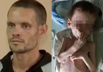 Orang Tua ini Tega Telantarkan Balita Berusia 4 Tahun Hingga Kurus Kering dan Hampir Mati Kelaparan