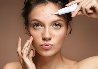 Hati-hati Jerawat Dapat Memicu Depresi! Inilah Cara Mengatasi Jerawat Meradang dengan Benar