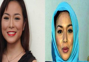Erna Libby Meninggal karena Tumor Otak, Ternyata Jenis Camilan Murah Meriah Ini Jadi Pemicunya