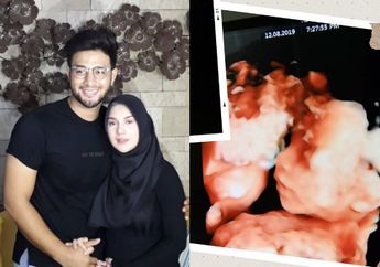 Sempat Menyepelekan Kaki Bengkak, Ternyata Itu Tanda Penyakit Irish Bella hingga Sebabkan Anak Kembarnya Meninggal di Dalam Kandungan