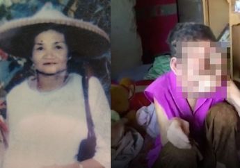 Berawal dari Memencet Jerawat, Wajah Wanita ini Rusak Parah Hingga Hancur dan Tak Bisa Lagi Dikenali