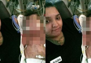 Sempat Tak Diperbolehkan Cium dan Gendong Bayinya yang Lahir Tanpa Kulit, Kini Maldonado Bisa Bernafas Lega Setelah sang Bayi Berhasil Jalani Cangkok Kulit