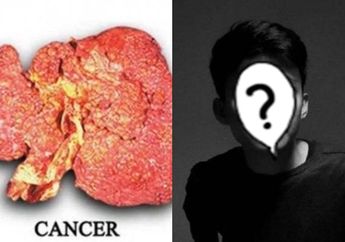 Komedian Berwajah Tampan Ini Meninggal Dunia karena Kanker Hati, Kenali Gejala Hingga Penyebab Utamanya!