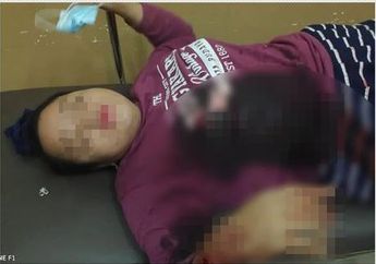 Tak Sudi Digugat Cerai Meski Sudah Pisah Ranjang, Suami di Sulsel Nekat Serempet Motor dan Tikam Istrinya hingga Berlumuran Darah