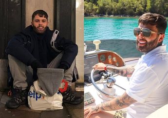 Miliarder ini Nekat Menjadi Gelandangan, Kedoknya Terbongkar karena Gigi Putih Seharga 73 Juta Hingga Diancam akan Dibunuh