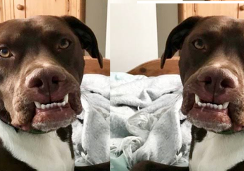 Mukanya Dicakar dan Diserang Anjing Buas Saat di Rumah Sendirian, Muka Gadis Kecil Ini Rusak Hingga 36 Jahitan