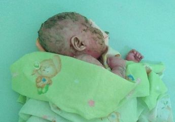 Kisah Pilu Bayi Mizyan, Menangis Kesakitan Tiap Kulitnya yang Seperti Plastik Mengelupas dan Berdarah, Sang Ayah: Ada Darah pada Bagian Kulit yang Lepas