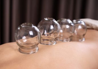 Ngeri, Lakukan Terapi Bekam Hingga Ketiduran Kulit Wanita ini Malah Melepuh dan Pembuluh Darahnya Pecah