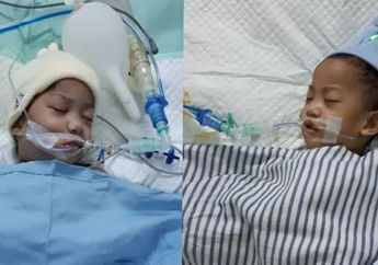 Kisah Bayi Kembar Siam Asal Kendari yang Berhasil Dipisah. Butuh 70 Dokter untuk Menanganinya!