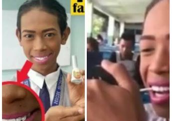 Gigi Putih Secara Instan, Cukup Gunakan Kuteks, Berani Coba Apa yang Dilakukan Remaja Philipina Ini?