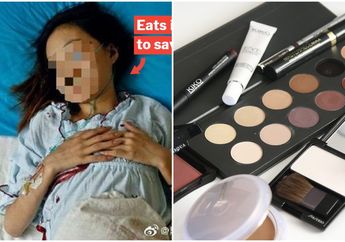 Bela-belain Berhemat Sampai Tak Makan Demi Beli Kosmetik, Wanita ini Justru Terkapar di Ranjang Akibat Penyakit Mematikan yang Mengancam Nyawa