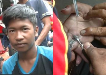 Jari Bocah Laki-laki Ini Bengkak Karena Terjepit Cincin, Sang Nenek Sampai Minta Tolong Petugas Pemadam Kebakaran untuk Selamatkan Cucunya