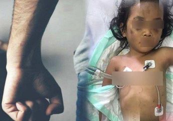 Nestapa Bocah 4 Tahun di Surabaya, Orangtuanya Ngaku Cuma Keracunan Obat, Dokter Justru Kaget Lihat Tubuhnya Lebam Hingga Mengigau Ketakutan dalam Tidurnya: Ampun Budhe...