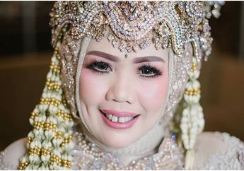 Sering Diejek Tonggos, Elly Sugigi Tak Keluar Uang Sepeser Untuk Rapikan Gigi: 'Ini Gratis Kok'