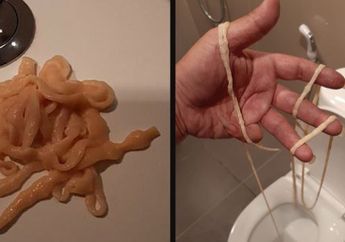 Susah Buang Air Besar, Pria di Thailand Syok Saat yang Keluar Cacing Pita Hidup Sepanjang 9 Meter!