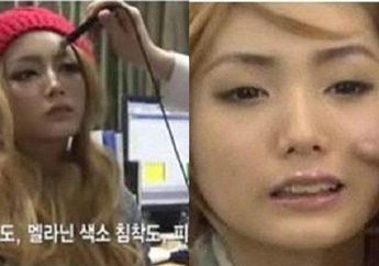 Bahaya Banget! 2 Tahun Berturut-turut Tak Pernah Hapus Make Up Bahkan saat Tidur, Wanita Cantik Ini Syok saat Dokter Hilangkan Riasannya, Kondisi Wajahnya Berubah Drastis!