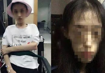 Terobsesi dengan Diet Ketat Selama 3 Tahun, Tubuh Wanita ini Kurus Kering, Otaknya Rusak, Hingga Koma Selama 40 Hari