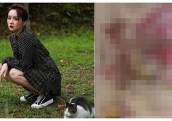 Alami Luka Bakar Hingga Tubuhnya Melepuh dan Bernanah Usai Jalani Terapi Bekam, Aktris Cantik Tiongkok Ini Beri Peringatan pada Netizen!