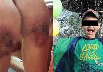 Hanya Gara-gara Pulang Terlambat, Bocah ini Dihukum Ayah Tirinya Berlutut di Atas Biji-bijian Selama 9 Jam, Akar Tanaman pun Tumbuh di Lututnya!