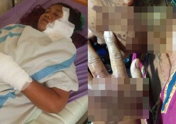 Seorang Ibu di Boyolali Disiram Air Keras oleh Orang Tak Dikenal Usai Antarkan Anak dan Cucunya Sekolah