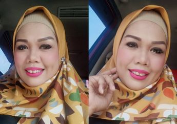 Dapat Fasilitas Gratis dari Klinik Kecantikan, Artis yang Kerap Dibully Netizen Ini Pamer Foto Terbaru yang Bikin Pangling: 'Makin Cantik Pok!' 