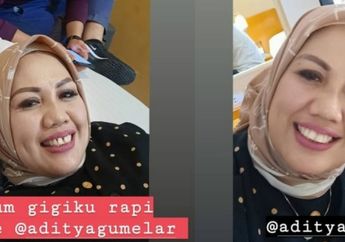 Bikin Pangling Netizen, Elly Sugigi Pamer Penampilan Barunya Usai Potong Gigi: Merubah Bukan Berarti Berubah