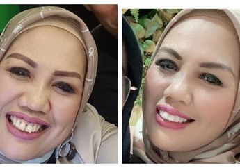 Potong Gigi Bagian Depannya, Ely Sugigi Dipuji Netizen: Menurut Dokter, Ini Efek Samping Potong Gigi