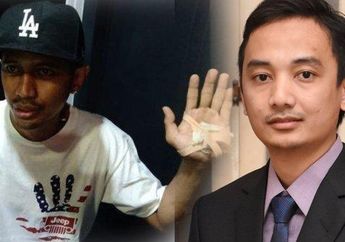 Sempat Heboh Anak Bupati Majalengka Tembak Seorang Kontraktor, Kini Si Pelaku Hanya Dituntut 2 Bulan Penjara, Ini Alasan Kejaksaan