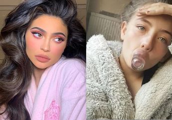 Remaja ini Tiru Tutorial Internet untuk Membuat Bibir Seksi Layaknya Kylie Jenner, Hasilnya Justru Seperti Disengat Lebah