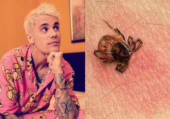 Gejala dan Penyebab Lyme Disease yang Dialami Justin Bieber, Penyakit yang Disebarkan oleh Kutu