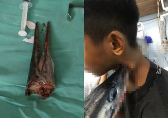 Ngeri! Lagi Asyik Melaut Tiba-tiba Ada Ikan Sori Terbang ke Perahunya, Moncong si Ikan Langsung Menancap di Leher Remaja Itu Hingga Tembus dan Bercucuran Darah