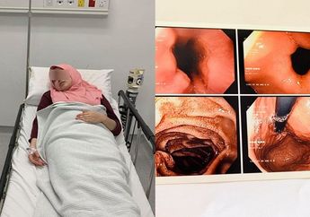 Keseringan Makan Makanan Pedas, Seorang Ibu Alami Sakit Lambung Parah Hingga Perutnya Naik ke Dada