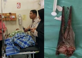 Sedang Santai Memancing, Remaja Ini Tiba-tiba Diserang Ikan Sori, Moncongnya Menancap Hingga Menembus Leher